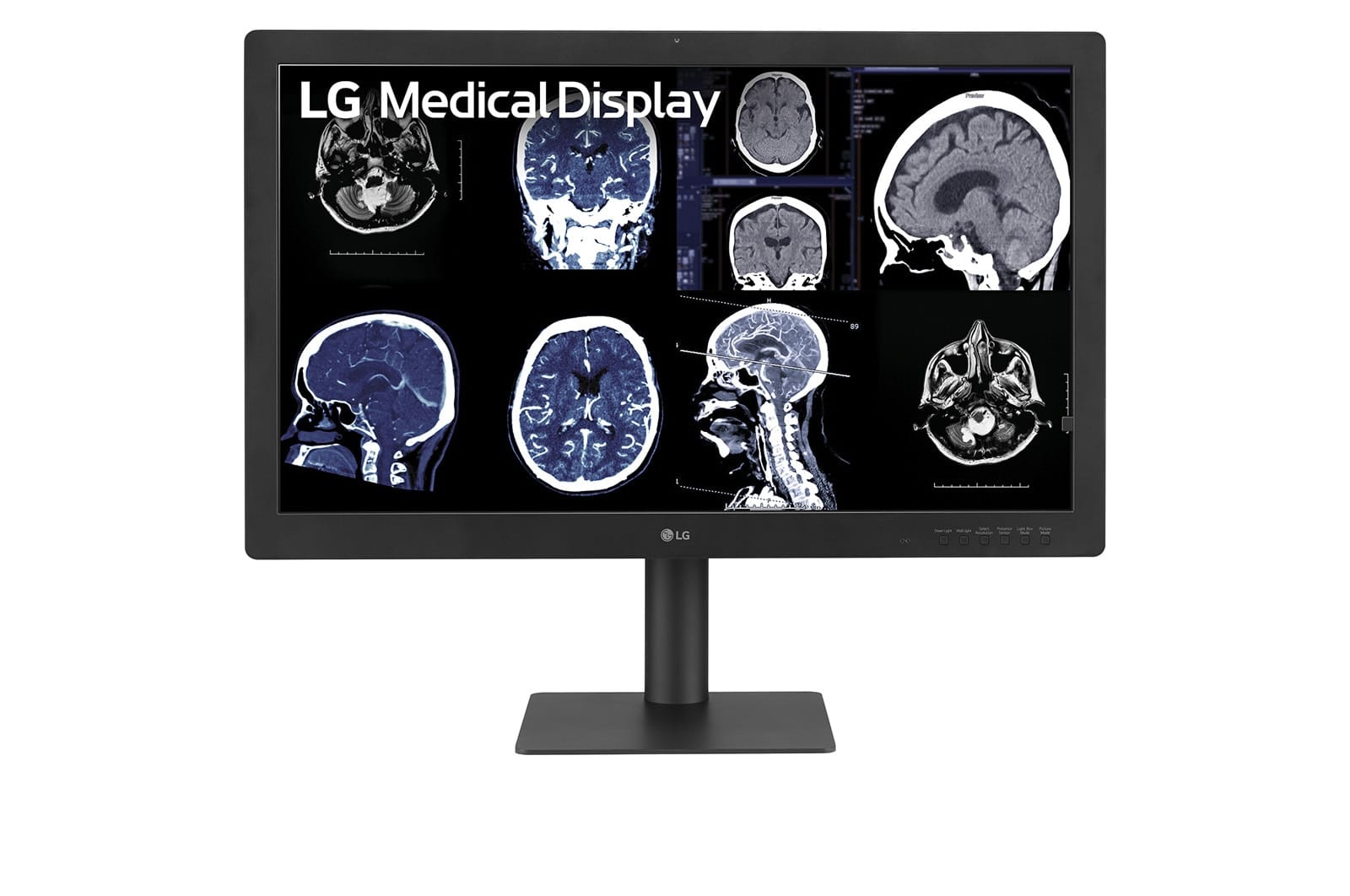 LG 32HQ713D B 31.5″ 8MP IPS Black diagnostic monitor, the model deployed at Alfred Health as part of its enterprise-wide switch from EIZO RadiForce to LG diagnostic displays