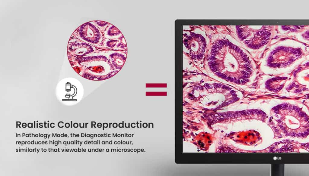 Medical Display Monitor showing its ability to Reproduce Realistic Colour on its screen