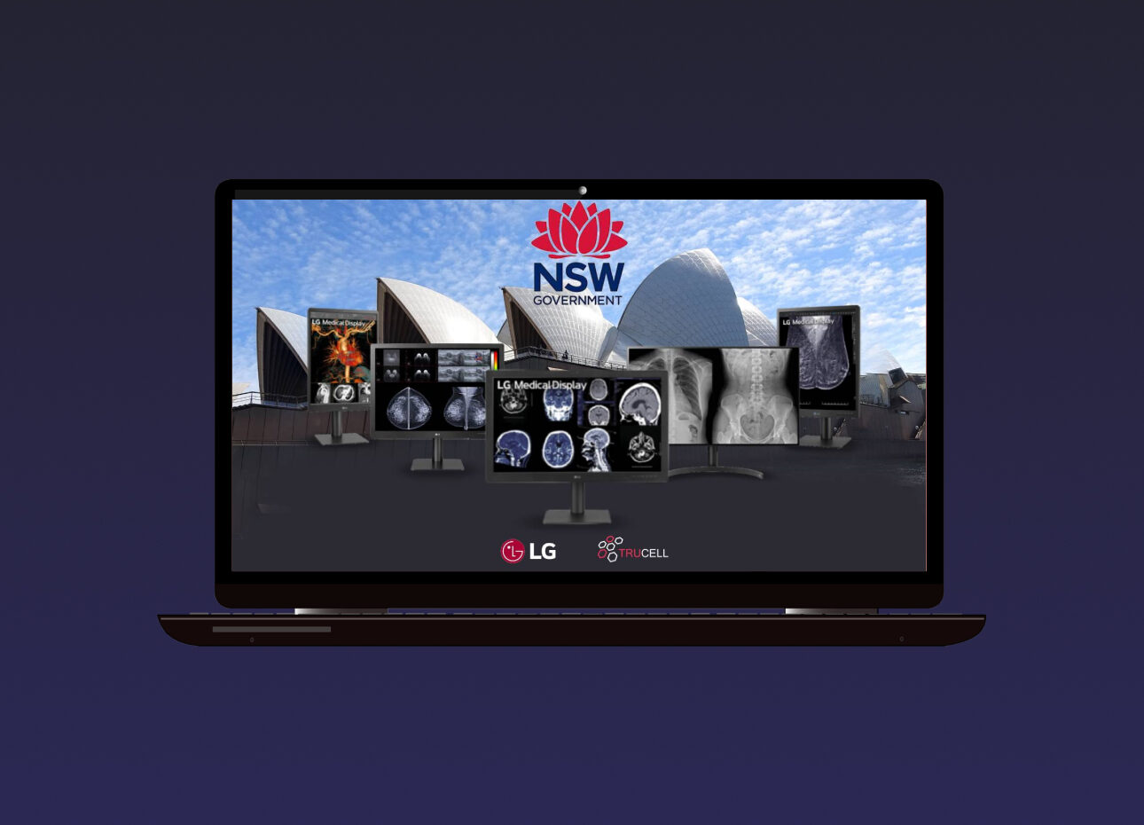 laptop showing LG Medical Monitors is showcased having Sydney Opera House at the background