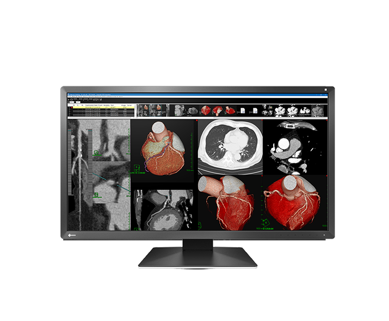EIZO RadiForce MX317W — 30.5" 8MP 4K Medical Monitor