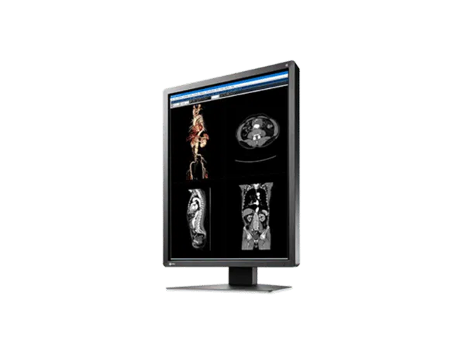 EIZO RadiForce MX216 — 21.3" 2MP Medical Monitor - Image 2